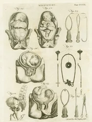 Porodnictví, ilustrace z 